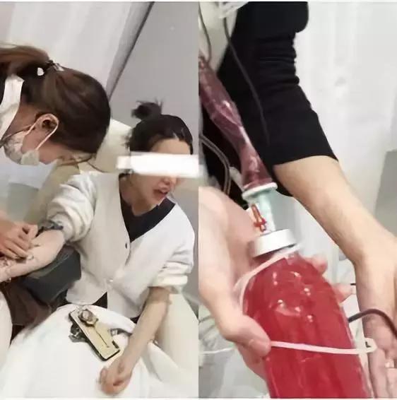 臭氧净化血液做几次效果好,血液净化加臭氧有什么好处