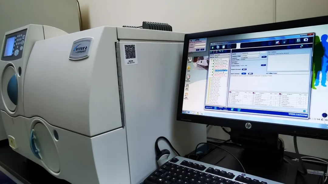 下腹痛白带水样,小腹疼白带多做什么检查