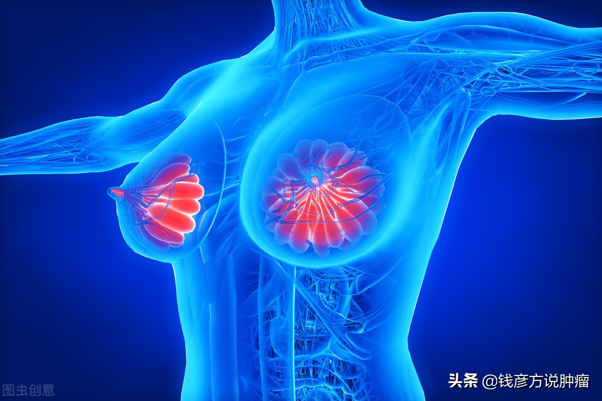 上海乳腺癌中医治疗全国最好医院,乳腺癌不化疗选择中医治疗科学吗