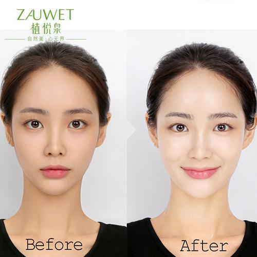 额头晒黑怎么快速变白,晒黑后如何快速变白的