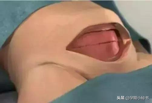 剖腹产最疼的是什么步骤,剖腹产手术步骤详解