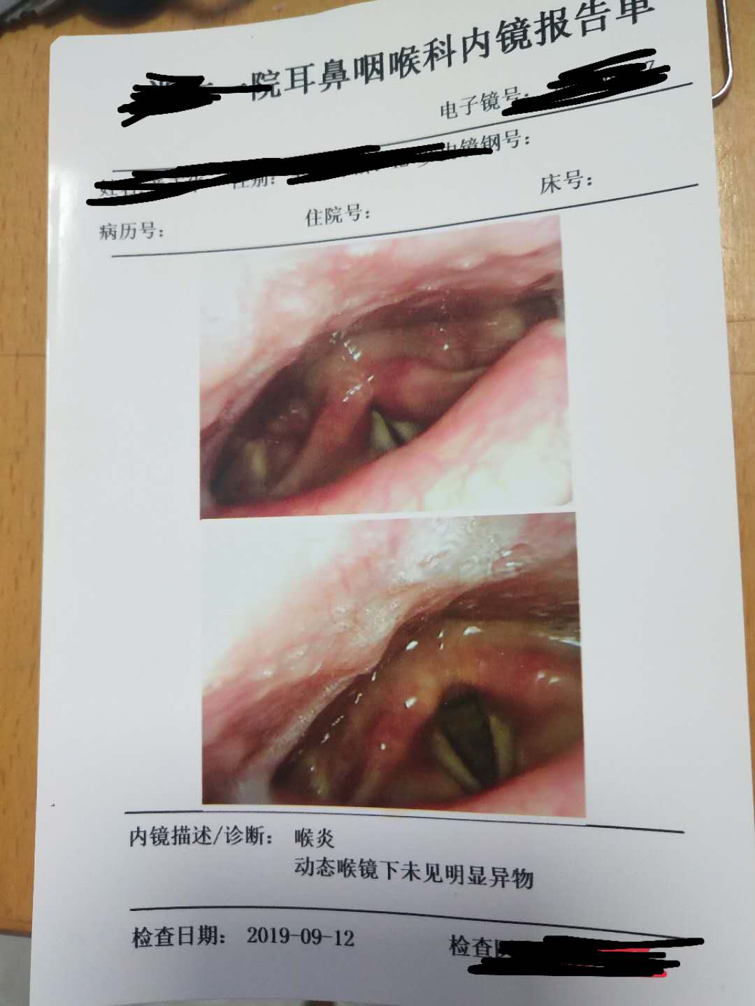求助鱼刺卡喉偏方,续三