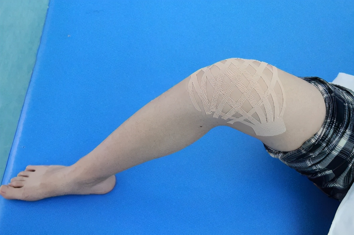 弹性贴布的原理,弹性贴布的作用