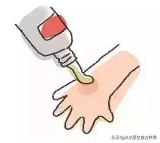 手上痒痒的小水泡，是过敏还是湿气重？教你这样处理它