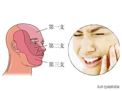 看盐湖区人民医院神经外科主任王京宽，如何降服“天下第一痛”