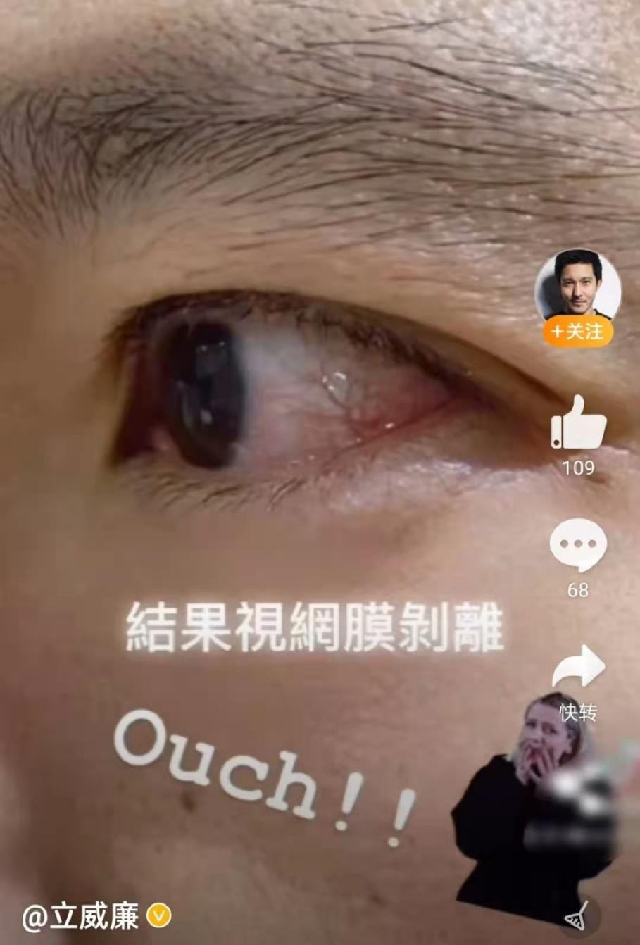 立威廉被女儿踢,立威廉被女儿踢破眼睛