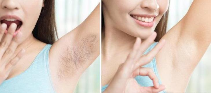 为什么女性身上的毛发旺盛,为什么有些女生身上毛发很多