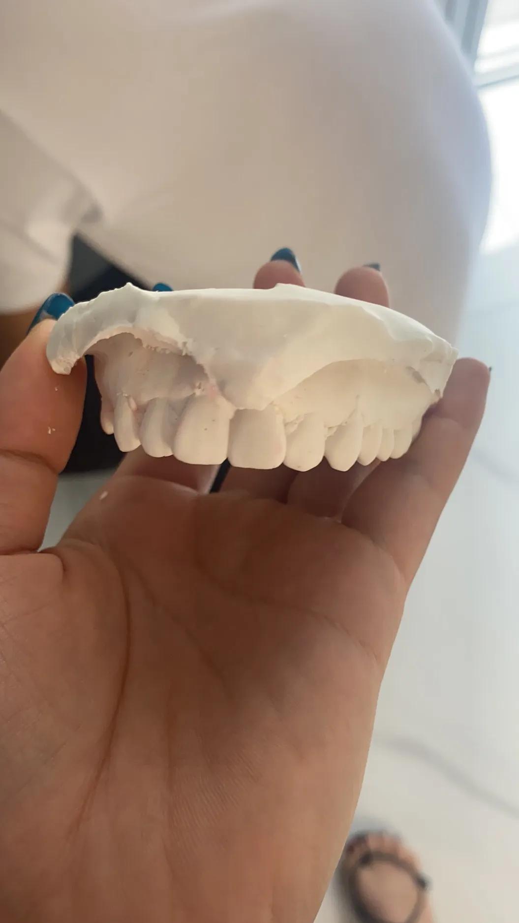 拔牙附近的牙隐隐痛酸是怎么回事,突然牙很酸痛是怎么回事