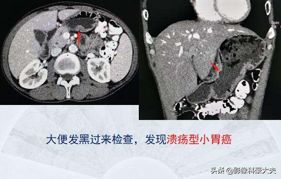 医圣张仲景，隔了1800年，用一盘饺子救了他