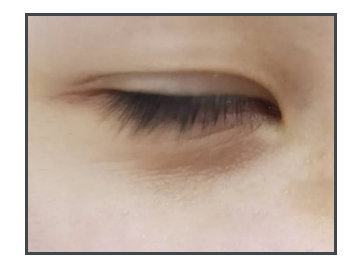 拯救黑眼圈泪沟的偏方,纯干货史上最全的对付黑眼圈攻略