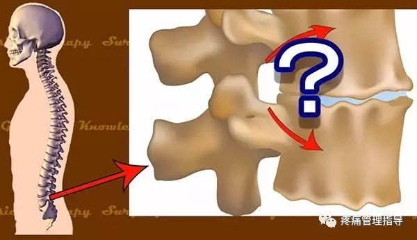 72岁老人腰疼还有骨刺该怎么治疗,老年人骨刺疼痛怎么治疗
