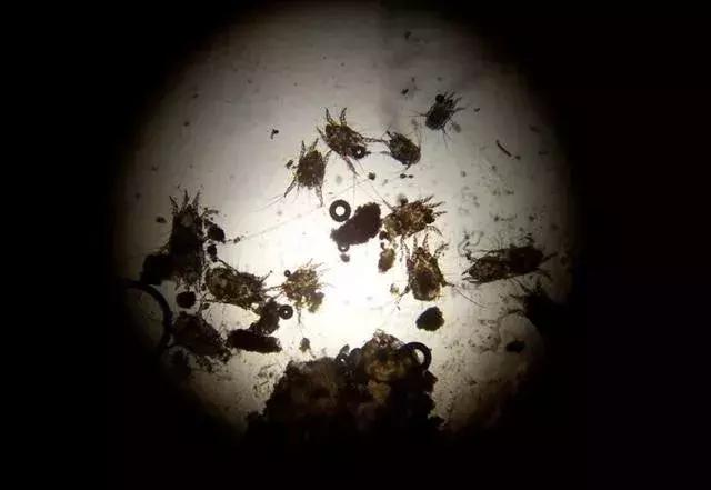 螨虫最怕的是什么办法,让螨虫远离你的简单方法