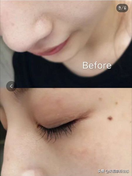 泥娃娃面膜用完还用补水吗,泥娃娃面膜的正确用法