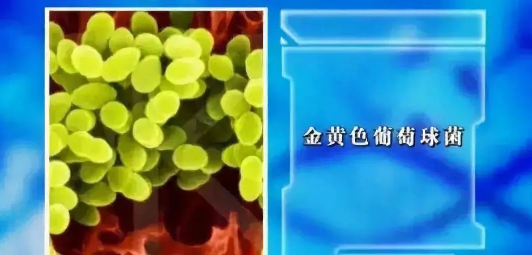 人体危险三角区的危害,身体三角区有哪些危险