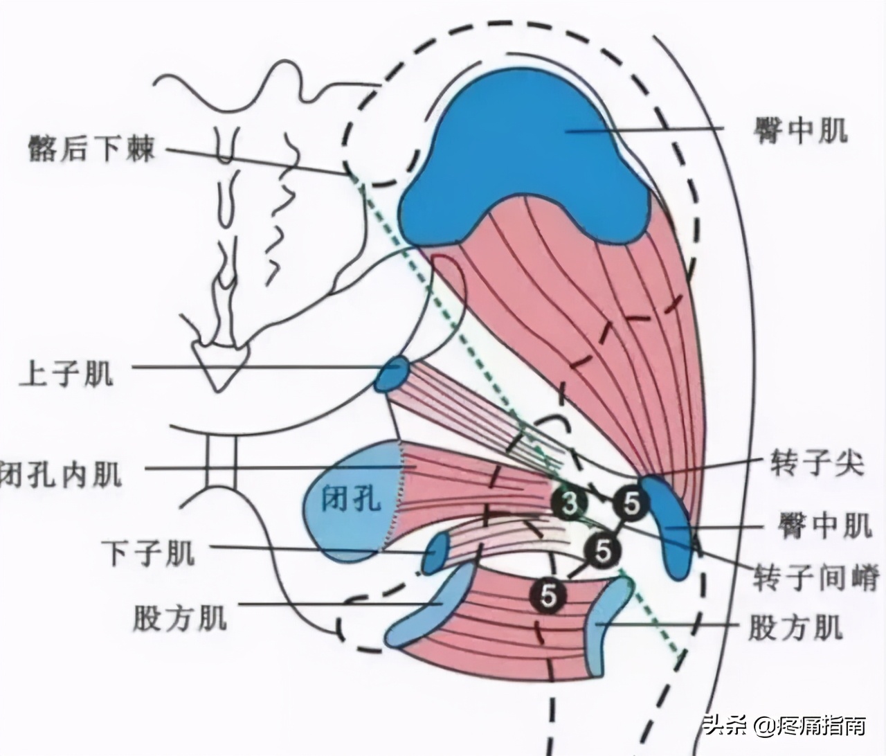夏天无注射液能治疗骨头坏死吗,骨头坏死用针刀镜有用么