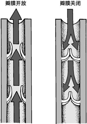 腿上爆青筋是静脉曲张吗,腿上爆出青筋是静脉曲张吗
