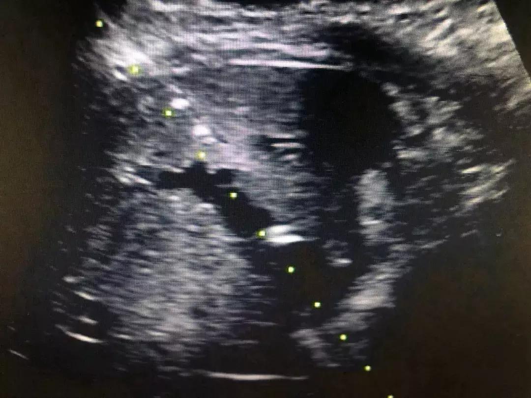 超声引导下的微创介入诊疗技术,超声引导下的神经阻滞技术电子版