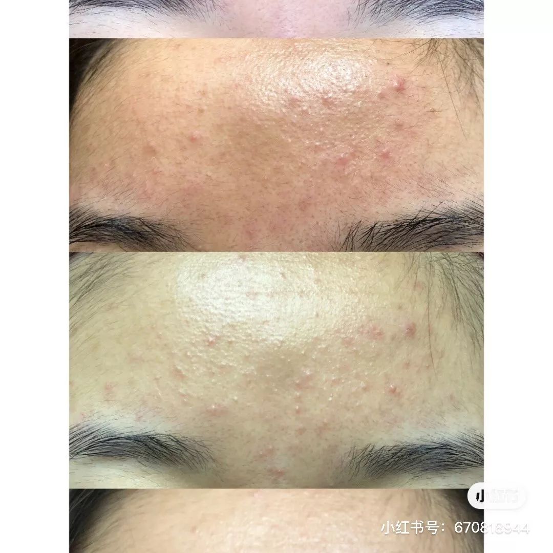 欧莱雅算不算欺诈消费,欧莱雅虚假宣传罚款多少