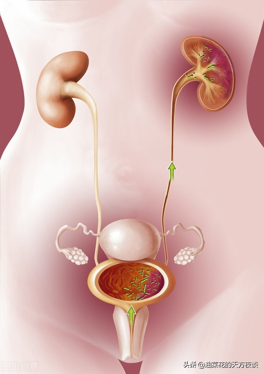 尿路感染久治不愈的原因是什么？