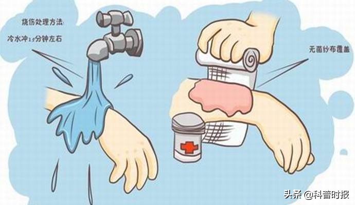 皮肤擦伤可以吃酱油吗,脸擦伤吃了两次酱油的东西没事吧