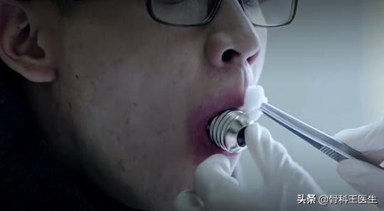 医院取出的异物怎么处理,医生都从患者体内取出过什么异物