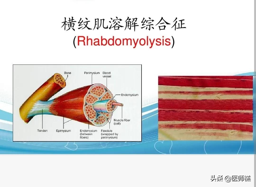 长期吃阿托伐他汀应该关注什么,长期服用阿托伐他汀会有什么后果