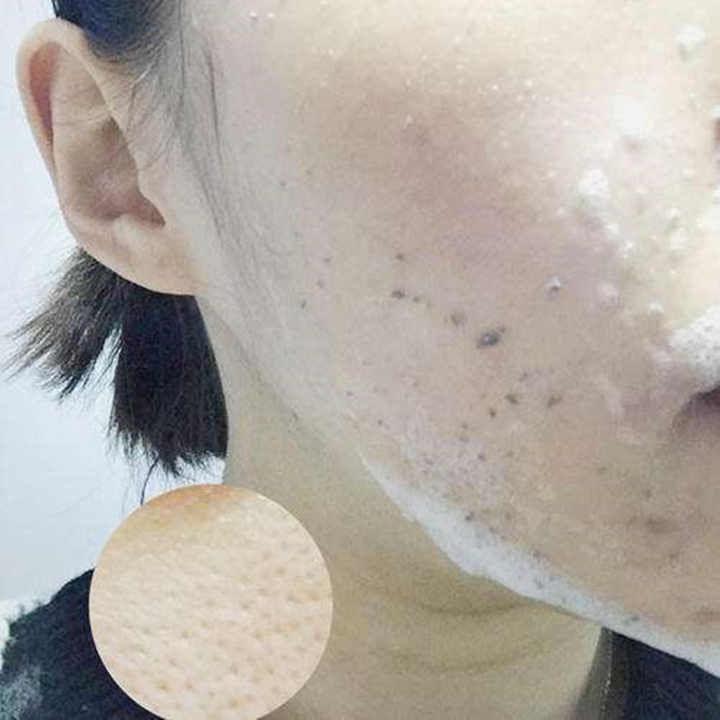 海边晒黑了怎么快速恢复变白,小孩被晒黑了怎么才能快速变白