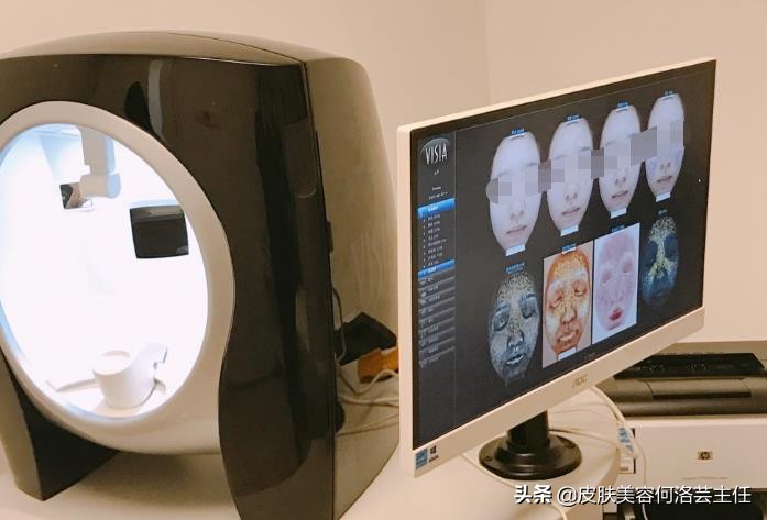 visia皮肤检测是什么原理,visia皮肤检测值多少是正常的