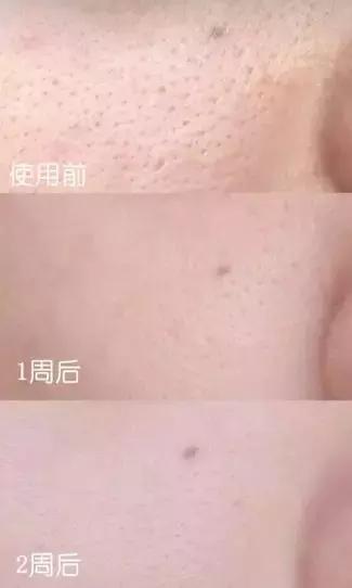 在家就能做的面部spa,在家可以做脸部spa吗