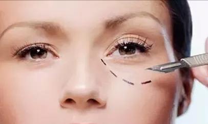 祛眼袋的治疗方法,祛眼袋真正有效的方法