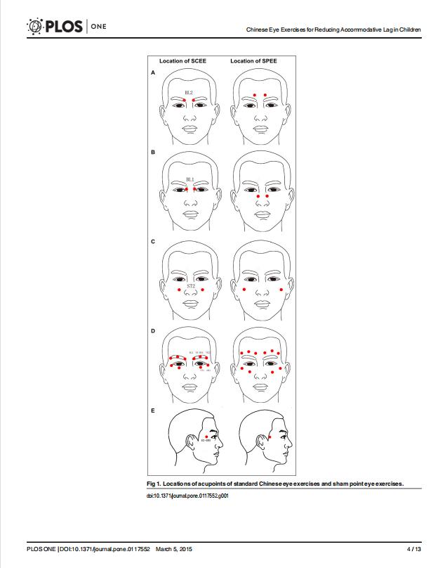 做了十几年的眼保健操真的有效吗,做眼保健操有必要闭眼吗