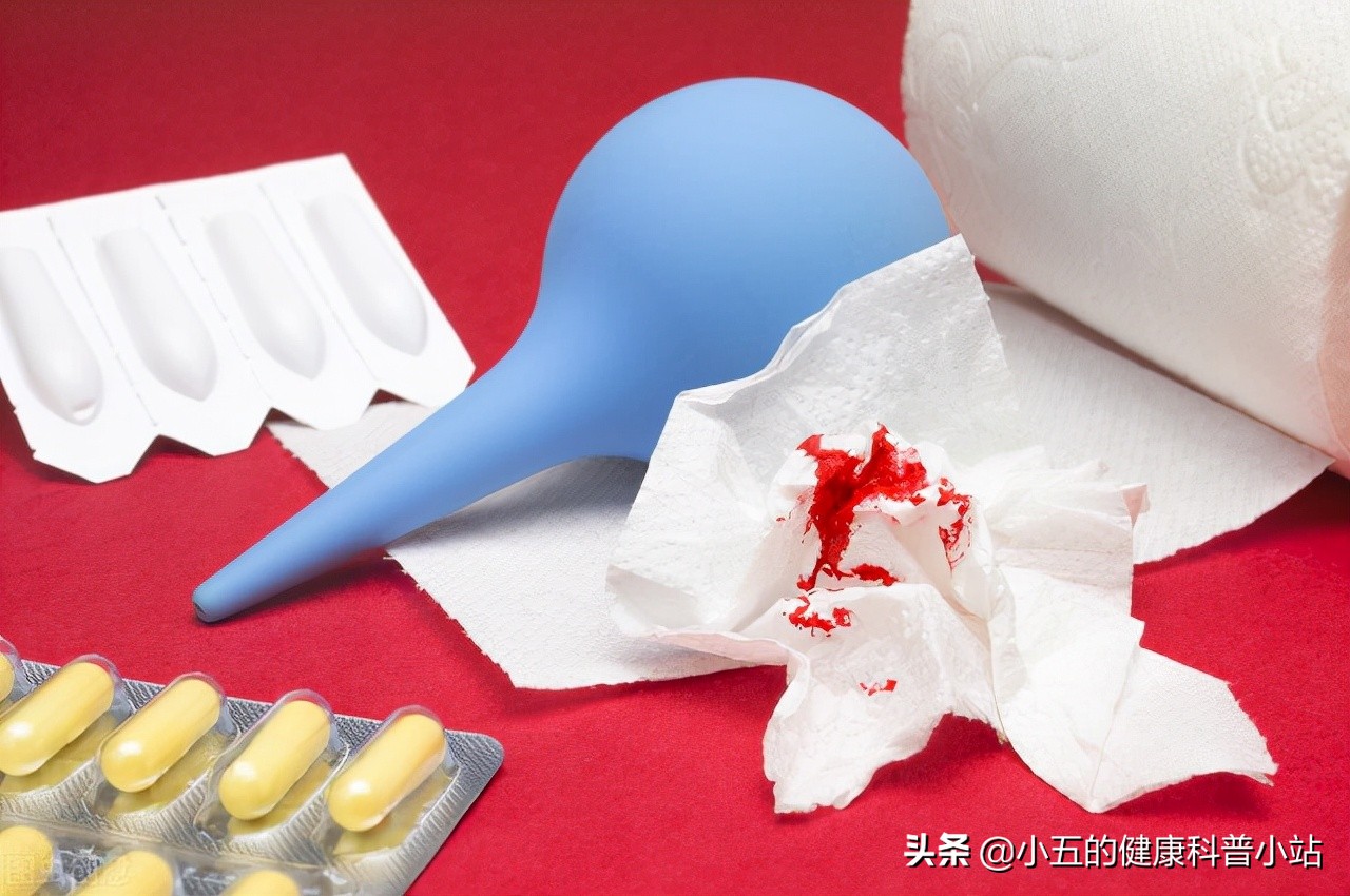 得了痔疮的人平时应该如何护理？除药物和手术治疗外还需关注6点