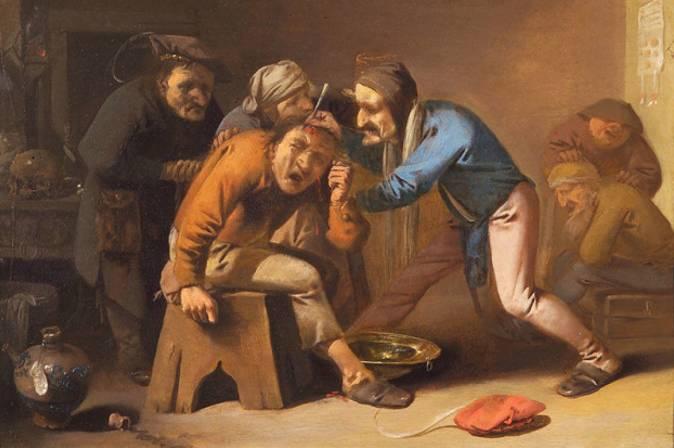 放血疗法西方,古代西方放血疗法有用吗