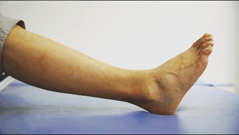 崴脚有什么好办法止痛,崴脚了怎么办用什么药