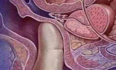 男医生的“一阳指”有多可怕？孕妈：尴尬到极点，能避开太幸运了