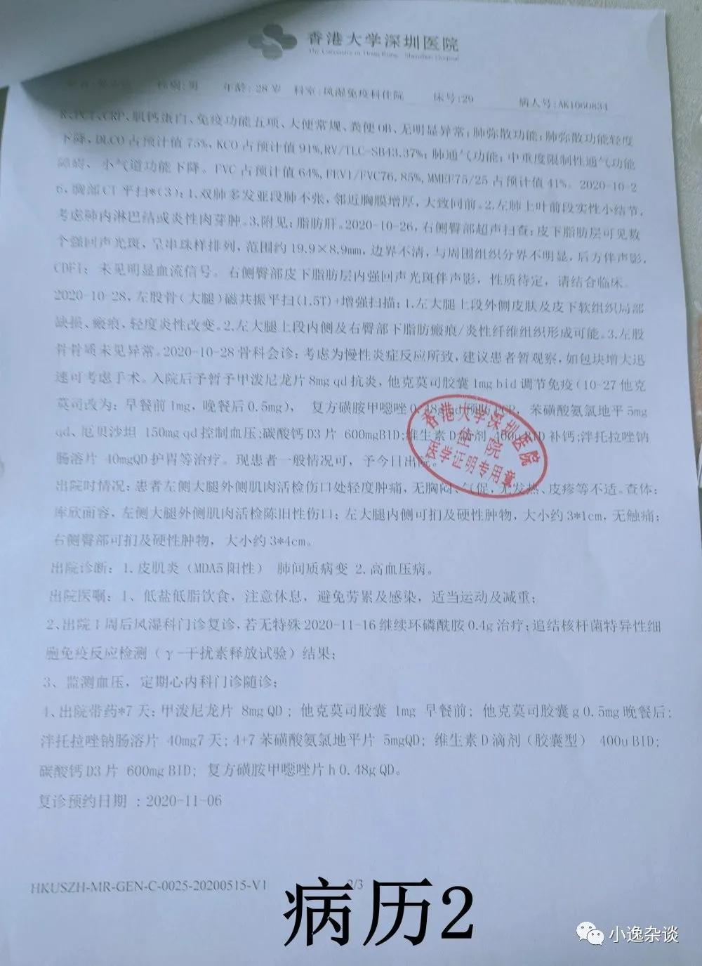 皮肌炎康复历程,皮肌炎治疗日记