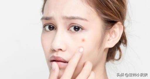 脸上长痘痘身上长痘的原因,脸上平常不长痘痘突然长痘痘