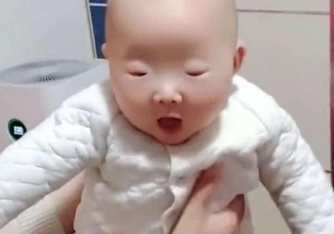 全网眼睛最小宝宝火了，李荣浩都要甘拜下风，网友：芝麻吃多了？