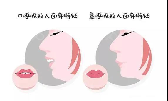 孩子天天刷牙还得龋齿,小孩天天刷牙怎么牙齿还是蛀了