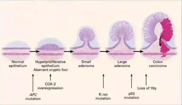 痔疮是人类为直立行走付出的代价